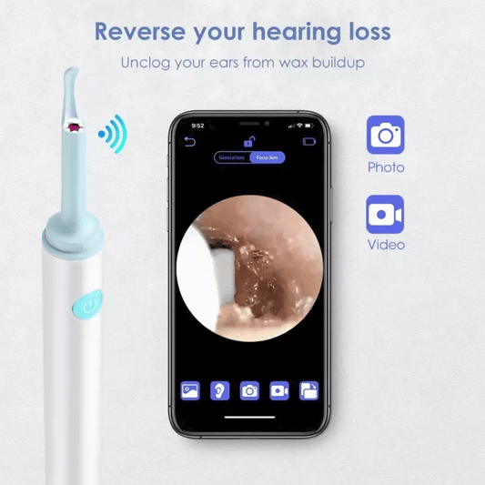 Earwax Removal Pro